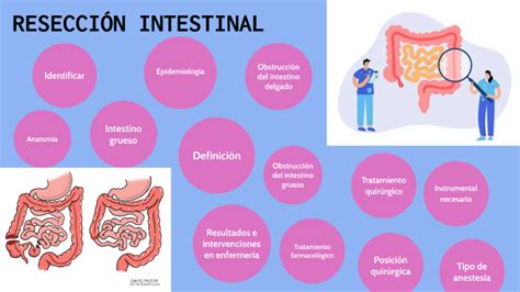 RESECCIÓN INTESTINAL by Fernanda García Torres on Prezi