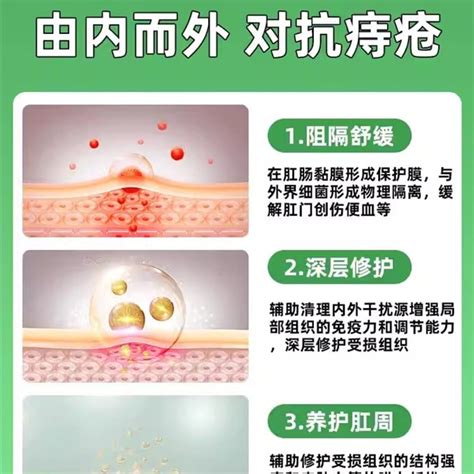 Hemorrhoid Cream Fleshball Anti Hemorrhoid Gel Anal Itching Chitosan