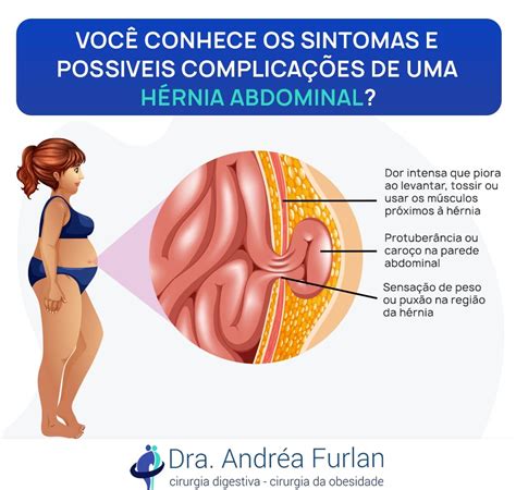 Sintomas De Hernia Abdominal Interna FDPLEARN