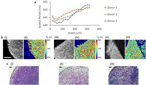 Conventional Oct Nsoct Imaging And Histological Analysis Of Day 21