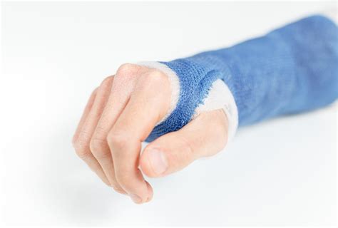 Waterproof Casts Hand Therapy Centre Newcastle And Maitland