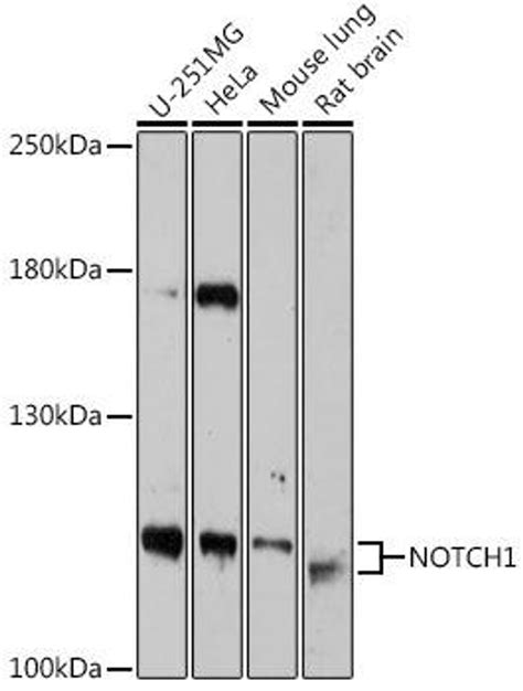 Anti Notch1 抗体 Cab18282 Assay Genie