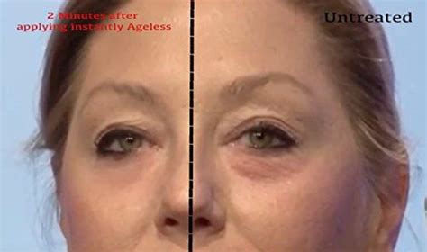 Instantly Agelesstm By Jeunesse Box Comes With Vials Anti Wrinkle