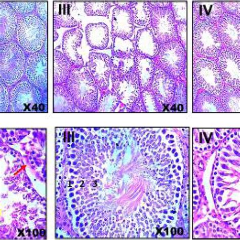 Photomicrographs Of The Testicular Histomorphology Of Adult Male Wistar