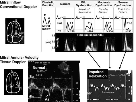 A Clinician’s Guide To Tissue Doppler Imaging Circulation