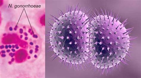 Gonorrhea Bacteria Structure