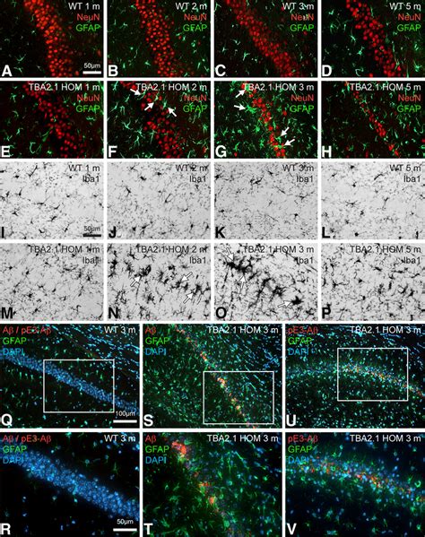 Progressing Astrogliosis Microglial Activation And Neuronal Loss In