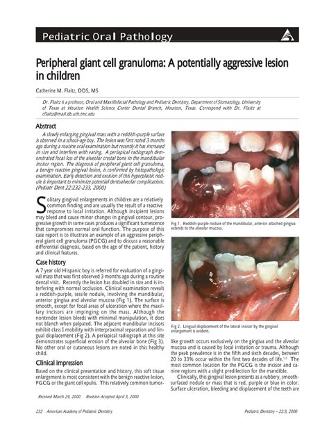 Peripheral Giant Cell Granuloma Vs Pyogenic Granuloma