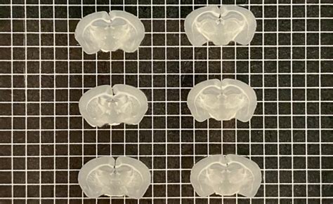 Microtome Types and Applications