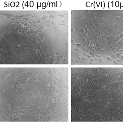 Morphology Of Human Normal Bronchial Epithelial Cells HNBEC In