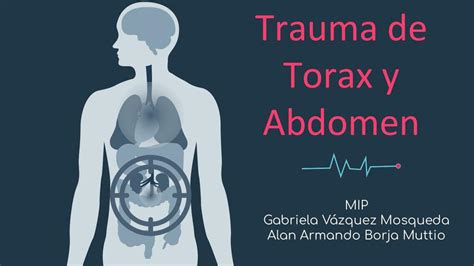 Trauma De Tórax Y Abdomen Idalia Ortiz Udocz