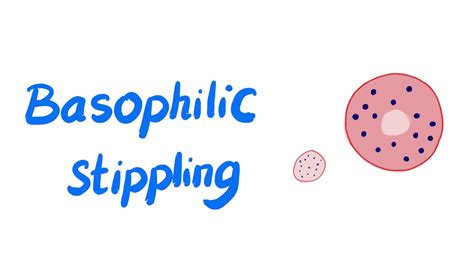 Basophilic Stippling of RBCs - YouTube