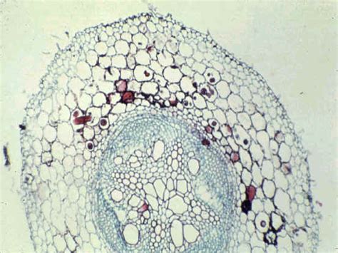 pratylenchus thornei