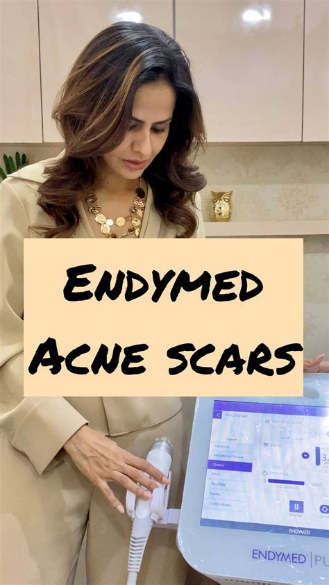 Acne Scars Garekars M D Dermatology Clinic