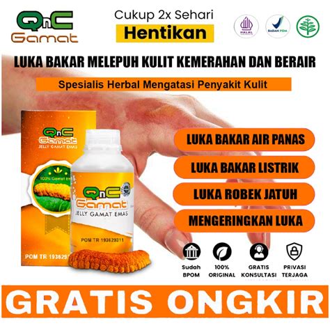 Jual COD Selep Luka Bakar Karena Air Panas Dan Keloid Obat