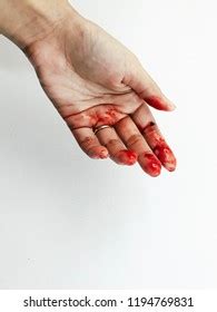 Cut Hand Bleeding Profusely Mishandling Sharp Stock Photo 1593566434 ...