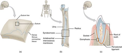 Unit 13: Joints – Douglas College Human Anatomy & Physiology I (2nd ed.)