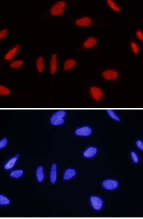 Human Ing1 Antibody R D Systems 100μg Unlabeledantibodies