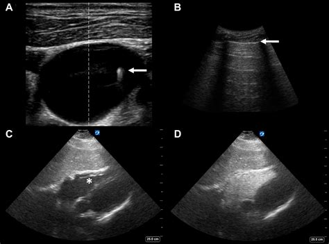 Neck And Chest Ultrasound at Robert Bader blog