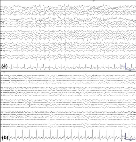 A Generalized Periodic Discharges With Characteristic Triphasic