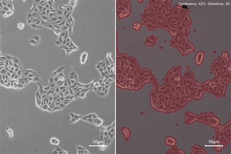 How To Determine Cell Confluency With A Digital Microscope Science