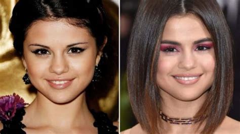 Selena Gomez S Before And After Looks Calm Down Singer S Beauty