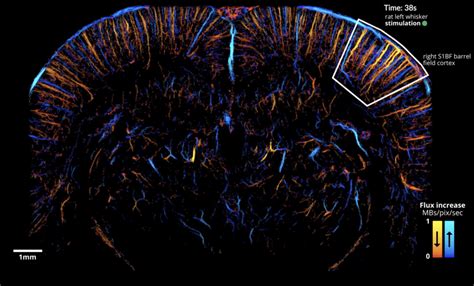 First Publication On Functional ULM Reveals Brain Wide Neurovascular