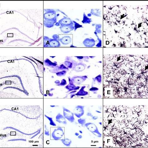 Hippocampal interleukin-6 (IL-6) mRNA levels at 4 (A) and 24 wk (B ... 