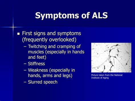 Ppt Amyotrophic Lateral Sclerosis Als Powerpoint Presentation Free