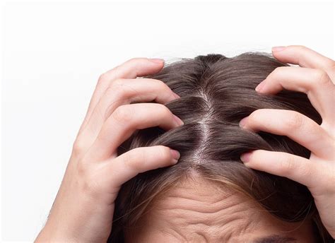 Caduta Capelli Donne Cause E Rimedi Alopecia Androgenetica Femminile