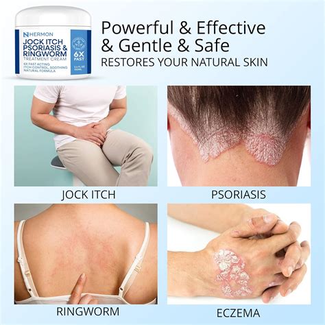 Antifungal Cream For Jock Itch Ringworm Psoriasis Comoros Ubuy