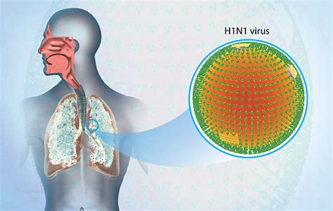 Health Condition : Symptoms, Causes, Treatment and More