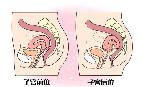 子宮前位vs子宮後位，哪種受孕率高？ 資訊咖