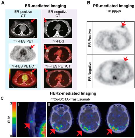 Ijms Free Full Text Review Receptor Targeted Nuclear Imaging Of