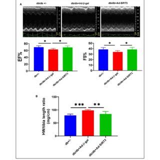 SIRT3 Gene Therapy Attenuated Cardiac Hypertrophy And Improved Cardiac