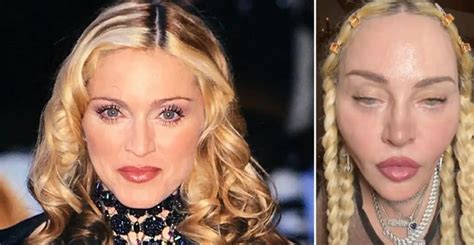 What Happened To Madonna S Face The Queen Of Pop S Plastic Surgery