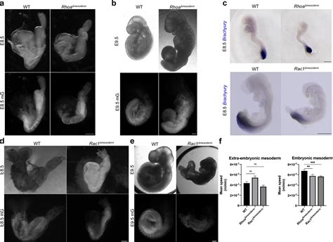 Figures And Data In Distinct Mesoderm Migration Phenotypes In Extra