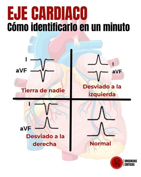 Eje cardiaco de manera fácil Cardiaco Cardiología Cardio