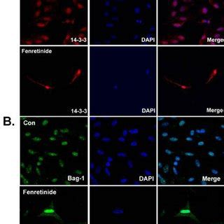 Effect Of Fenretinide Treatment On Pax Tubulin Iii Nse