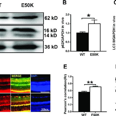 The Optn E50k Point Mutation Affects Autophagy And The Colocalization