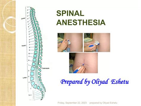 Spinal_Anaesthesia.ppt