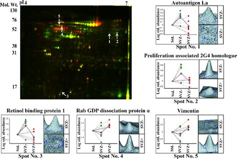 Tissue Proteomic Analysis Of Svz N 6 And Svz− N 6 Gbms Using Download Scientific