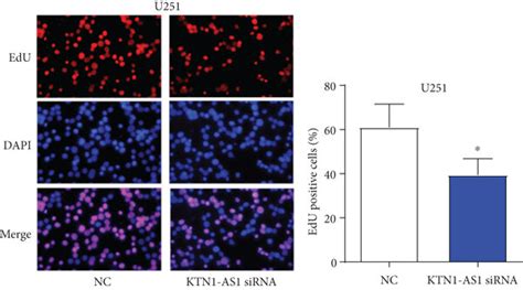 Ktn1 As1 Facilitates Proliferation Migration And Invasion In Gbm