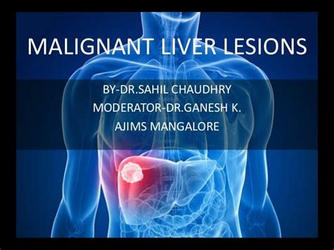 What Causes Lesions On The Liver