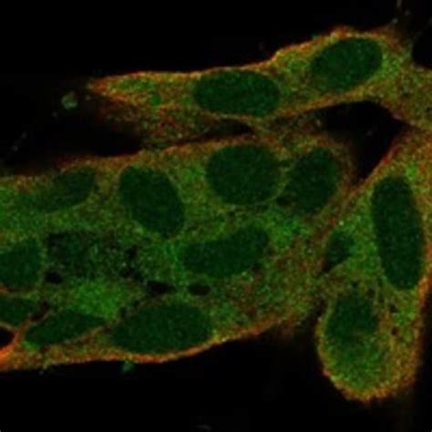 S100g Polyclonal Antibody Invitrogen 100 μl Unconjugatedantibodies