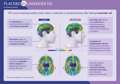 New data shows lavender oil significantly improves anxiety induced insomnia