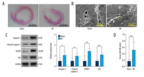 NF κB Gasdermin D GSDMD Axis Couples Oxidative Stress and NACHT LRR