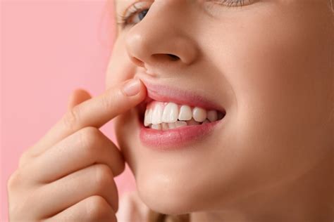 Gum Grafting A Solution For Gum Recession And Tooth Sensitivity