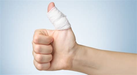 Is My Thumb Broken or Sprained? | Complete Care