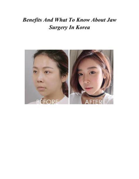 Benefits And What To Know About Jaw Surgery In Korea